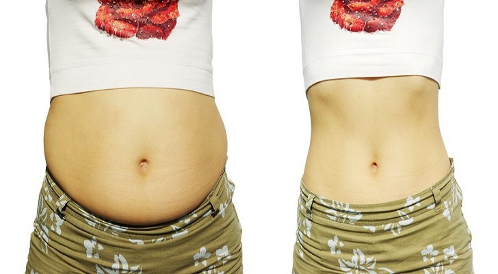 Stomach Bloating Symptoms, Causes, Diagnosis and Treatment
