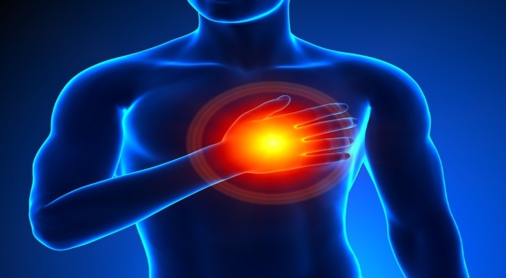 Cardiomyopathy Symptoms, Causes and Types