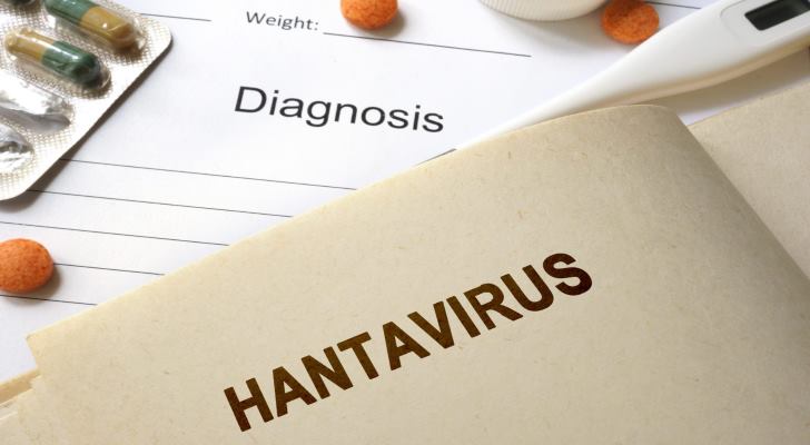 Hantavirus (HPS) Causes, Symptoms and Diagnosing