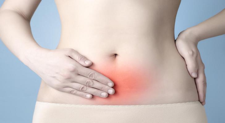 Endometriosis Symptoms and Signs