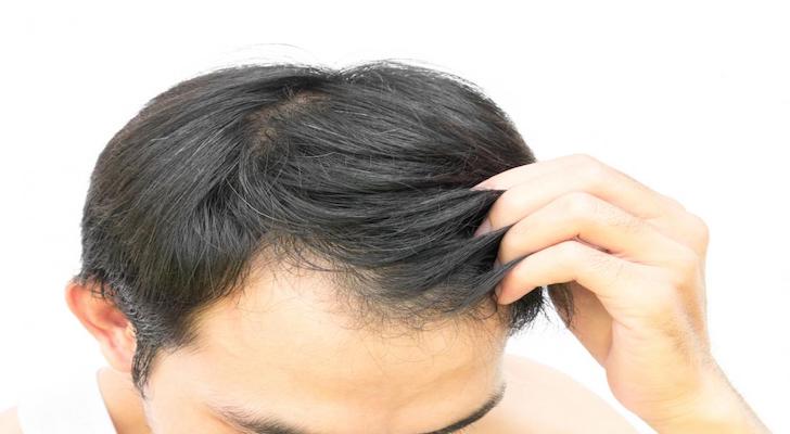 Cure Hair Loss. The Best Hair Growth Treatment