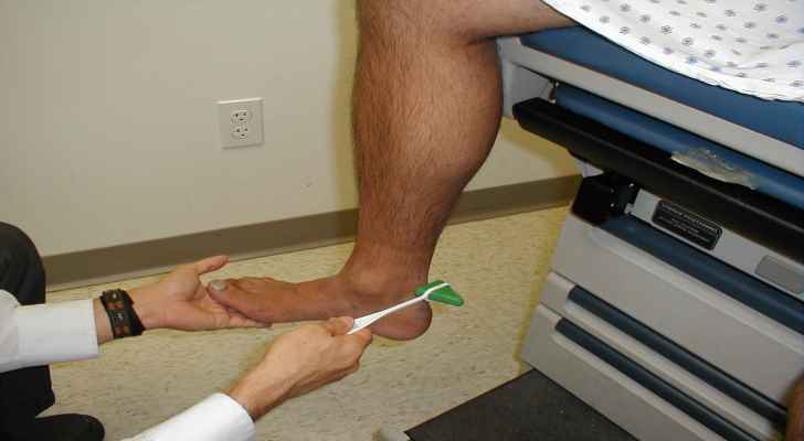 Shin Splints Causes, Symptoms and Prevention