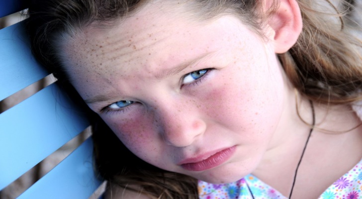Rosacea Symptoms and Signs