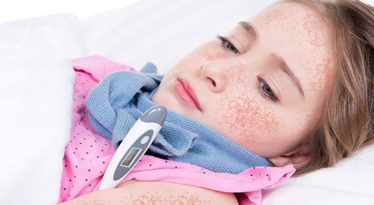 What Are the Symptoms of Scarlet Fever?